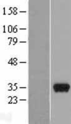Western Blot: Peflin Overexpression Lysate (Adult Normal) [NBL1-14278] Left-Empty vector transfected control cell lysate (HEK293 cell lysate); Right -Over-expression Lysate for Peflin.
