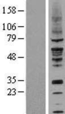 Western Blot: Nicotinic Acetylcholine Receptor beta 4 Overexpression Lysate (Adult Normal) [NBL1-09189] Left-Empty vector transfected control cell lysate (HEK293 cell lysate); Right -Over-expression Lysate for Nicotinic Acetylcholine Receptor beta 4.