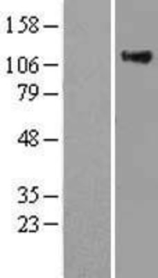 Western Blot: RAS p21 Overexpression Lysate (Adult Normal) [NBL1-15164] Left-Empty vector transfected control cell lysate (HEK293 cell lysate); Right -Over-expression Lysate for RAS p21.