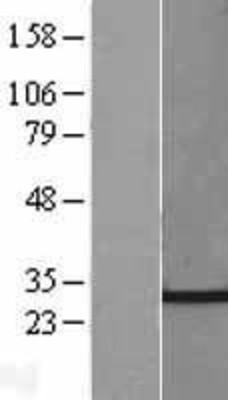 Western Blot: CHMP4C Overexpression Lysate (Adult Normal) [NBL1-09161] Left-Empty vector transfected control cell lysate (HEK293 cell lysate); Right -Over-expression Lysate for CHMP4C.