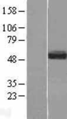 Western Blot: SMOC1 Overexpression Lysate (Adult Normal) [NBL1-16246] Left-Empty vector transfected control cell lysate (HEK293 cell lysate); Right -Over-expression Lysate for SMOC1.