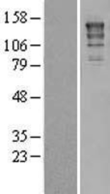 Western Blot: XPG Overexpression Lysate (Adult Normal) [NBL1-10323] Left-Empty vector transfected control cell lysate (HEK293 cell lysate); Right -Over-expression Lysate for XPG.