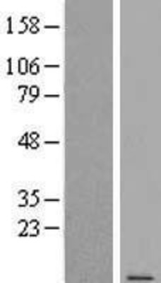 Western Blot: STRA13 Overexpression Lysate (Adult Normal) [NBL1-16565] Left-Empty vector transfected control cell lysate (HEK293 cell lysate); Right -Over-expression Lysate for STRA13.