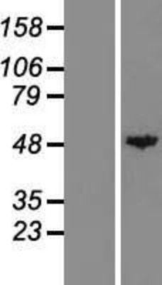Western Blot: Carboxypeptidase A Overexpression Lysate (Adult Normal) [NBL1-09424] Left-Empty vector transfected control cell lysate (HEK293 cell lysate); Right -Over-expression Lysate for Carboxypeptidase A.
