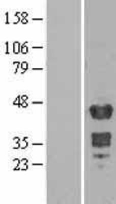 Western Blot: Muscleblind-like 1 Overexpression Lysate (Adult Normal) [NBL1-12929] Left-Empty vector transfected control cell lysate (HEK293 cell lysate); Right -Over-expression Lysate for Muscleblind-like 1.