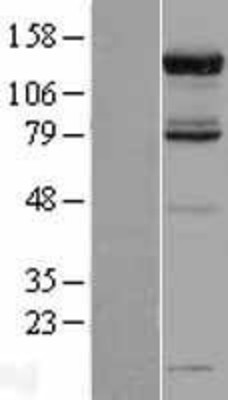 Western Blot: USP52 Overexpression Lysate (Adult Normal) [NBL1-14090] Left-Empty vector transfected control cell lysate (HEK293 cell lysate); Right -Over-expression Lysate for USP52.