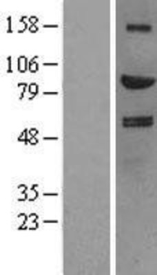 Western Blot: HGF Overexpression Lysate (Adult Normal) [NBL1-11527] Left-Empty vector transfected control cell lysate (HEK293 cell lysate); Right -Over-expression Lysate for HGF.