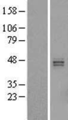 Western Blot: HS3ST5 Overexpression Lysate (Adult Normal) [NBL1-11715] Left-Empty vector transfected control cell lysate (HEK293 cell lysate); Right -Over-expression Lysate for HS3ST5.