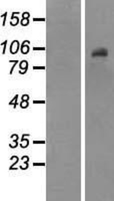 Western Blot: Dnmt3b Overexpression Lysate (Adult Normal) [NBP2-07562] Left-Empty vector transfected control cell lysate (HEK293 cell lysate); Right -Over-expression Lysate for Dnmt3b.