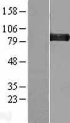 Western Blot: Glycogen Synthase Overexpression Lysate (Adult Normal) [NBL1-11415] Left-Empty vector transfected control cell lysate (HEK293 cell lysate); Right -Over-expression Lysate for Glycogen Synthase.