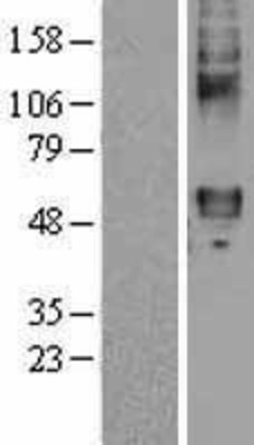 Western Blot: Frizzled-4 Overexpression Lysate (Adult Normal) [NBL1-10890] Left-Empty vector transfected control cell lysate (HEK293 cell lysate); Right -Over-expression Lysate for Frizzled-4.