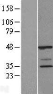 Western Blot: POLR2C Overexpression Lysate (Adult Normal) [NBL1-14580] Left-Empty vector transfected control cell lysate (HEK293 cell lysate); Right -Over-expression Lysate for POLR2C.