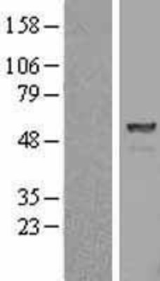 Western Blot: Proteasome 26S S5 Overexpression Lysate (Adult Normal) [NBL1-14903] Left-Empty vector transfected control cell lysate (HEK293 cell lysate); Right -Over-expression Lysate for Proteasome 26S S5.