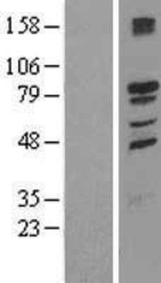 Western Blot: TMCC1 Overexpression Lysate (Adult Normal) [NBL1-16975] Left-Empty vector transfected control cell lysate (HEK293 cell lysate); Right -Over-expression Lysate for TMCC1.