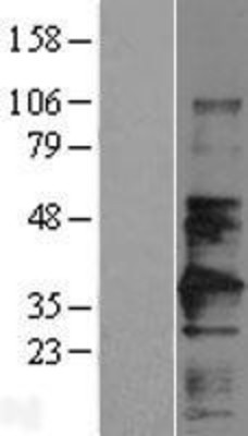 Western Blot: CD147 Overexpression Lysate (Adult Normal) [NBL1-08037] Left-Empty vector transfected control cell lysate (HEK293 cell lysate); Right -Over-expression Lysate for CD147.