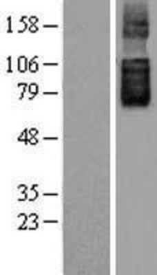 Western Blot: SLC26A6 Overexpression Lysate (Adult Normal) [NBL1-16078] Left-Empty vector transfected control cell lysate (HEK293 cell lysate); Right -Over-expression Lysate for SLC26A6.