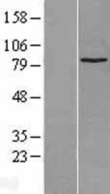 Western Blot: SUZ12 Overexpression Lysate (Adult Normal) [NBL1-16629] Left-Empty vector transfected control cell lysate (HEK293 cell lysate); Right -Over-expression Lysate for SUZ12.