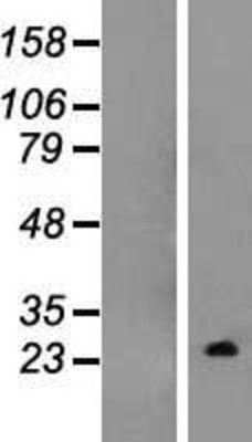 Western Blot: TC10 Overexpression Lysate (Adult Normal) [NBL1-15359] Left-Empty vector transfected control cell lysate (HEK293 cell lysate); Right -Over-expression Lysate for TC10.