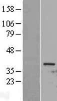 Western Blot: Cdc2 Overexpression Lysate (Adult Normal) [NBL1-08991] Left-Empty vector transfected control cell lysate (HEK293 cell lysate); Right -Over-expression Lysate for Cdc2.