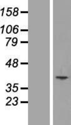 Western Blot: MCART1 Overexpression Lysate (Adult Normal) [NBL1-12942] Left-Empty vector transfected control cell lysate (HEK293 cell lysate); Right -Over-expression Lysate for MCART1.