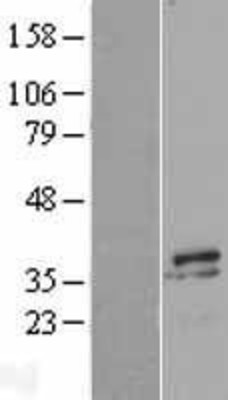 Western Blot: Myozenin 2 Overexpression Lysate (Adult Normal) [NBL1-13447] Left-Empty vector transfected control cell lysate (HEK293 cell lysate); Right -Over-expression Lysate for Myozenin 2.