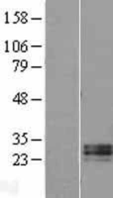 Western Blot: RNASE11 Overexpression Lysate (Adult Normal) [NBL1-15393] Left-Empty vector transfected control cell lysate (HEK293 cell lysate); Right -Over-expression Lysate for RNASE11.