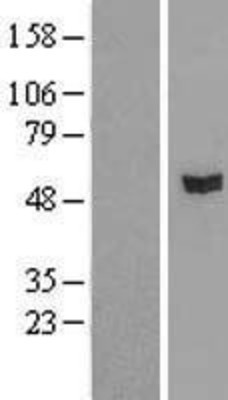 Western Blot: RASGEF1A Overexpression Lysate (Adult Normal) [NBL1-15170] Left-Empty vector transfected control cell lysate (HEK293 cell lysate); Right -Over-expression Lysate for RASGEF1A.
