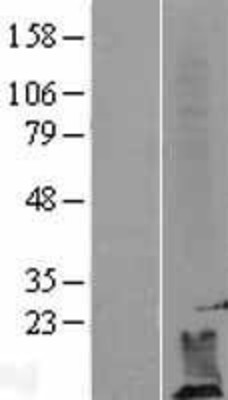 Western Blot: DPM2 Overexpression Lysate (Adult Normal) [NBL1-09993] Left-Empty vector transfected control cell lysate (HEK293 cell lysate); Right -Over-expression Lysate for DPM2.