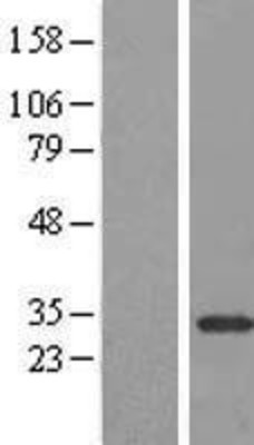 Western Blot: CPSF4 Overexpression Lysate (Adult Normal) [NBL1-09448] Left-Empty vector transfected control cell lysate (HEK293 cell lysate); Right -Over-expression Lysate for CPSF4.
