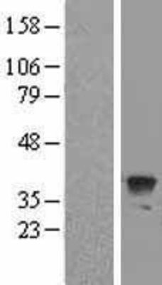 Western Blot: Apg3 Overexpression Lysate (Adult Normal) [NBL1-07796] Left-Empty vector transfected control cell lysate (HEK293 cell lysate); Right -Over-expression Lysate for Apg3.