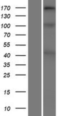 Western Blot: Collagen XI alpha 2 Overexpression Lysate (Adult Normal) [NBP2-05767] Left-Empty vector transfected control cell lysate (HEK293 cell lysate); Right -Over-expression Lysate for Collagen XI alpha 2.