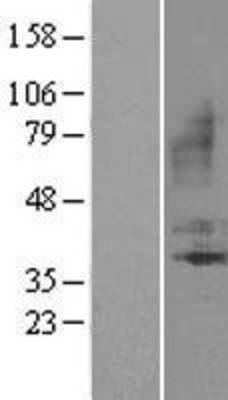 Western Blot: BDKRB1 Overexpression Lysate (Adult Normal) [NBL1-07959] Left-Empty vector transfected control cell lysate (HEK293 cell lysate); Right -Over-expression Lysate for BDKRB1.