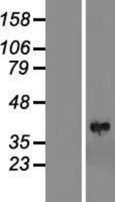Western Blot: LIMS1 Overexpression Lysate (Adult Normal) [NBL1-12539] Left-Empty vector transfected control cell lysate (HEK293 cell lysate); Right -Over-expression Lysate for LIMS1.