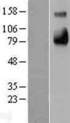 Western Blot: E-selectin Overexpression Lysate (Adult Normal) [NBL1-15790] Left-Empty vector transfected control cell lysate (HEK293 cell lysate); Right -Over-expression Lysate for E-selectin.
