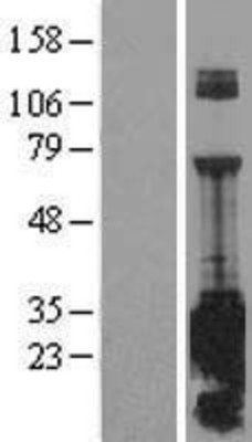 Western Blot: SNAP25 Overexpression Lysate (Adult Normal) [NBL1-16268] Left-Empty vector transfected control cell lysate (HEK293 cell lysate); Right -Over-expression Lysate for SNAP25.