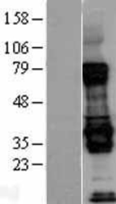 Western Blot: Livin Overexpression Lysate (Adult Normal) [NBL1-07988] Left-Empty vector transfected control cell lysate (HEK293 cell lysate); Right -Over-expression Lysate for Livin.