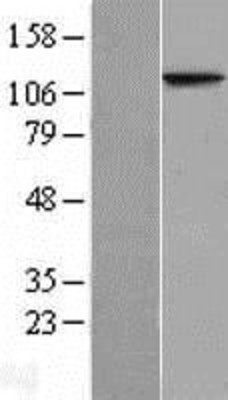 Western Blot: NAT10 Overexpression Lysate (Adult Normal) [NBL1-13485] Left-Empty vector transfected control cell lysate (HEK293 cell lysate); Right -Over-expression Lysate for NAT10.