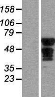 Western Blot: SLC6A18 Overexpression Lysate (Adult Normal) [NBP2-04823] Left-Empty vector transfected control cell lysate (HEK293 cell lysate); Right -Over-expression Lysate for SLC6A18.