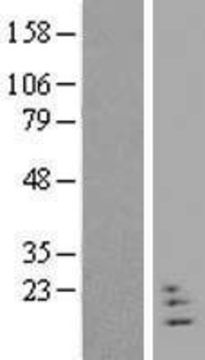 Western Blot: neuritin 1-like Overexpression Lysate (Adult Normal) [NBP2-04700] Left-Empty vector transfected control cell lysate (HEK293 cell lysate); Right -Over-expression Lysate for neuritin 1-like.
