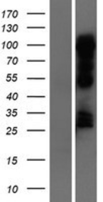 Western Blot: NR1D1 Overexpression Lysate (Adult Normal) [NBP2-06523] Left-Empty vector transfected control cell lysate (HEK293 cell lysate); Right -Over-expression Lysate for NR1D1.