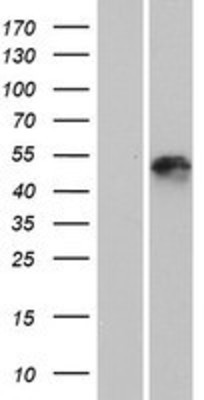 Western Blot: KRT25 Overexpression Lysate (Adult Normal) [NBP2-04910] Left-Empty vector transfected control cell lysate (HEK293 cell lysate); Right -Over-expression Lysate for KRT25.