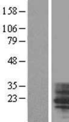 Western Blot: TM4SF4 Overexpression Lysate (Adult Normal) [NBL1-16966] Left-Empty vector transfected control cell lysate (HEK293 cell lysate); Right -Over-expression Lysate for TM4SF4.