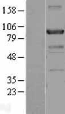 Western Blot: Centaurin beta 2 Overexpression Lysate (Adult Normal) [NBL1-09095] Left-Empty vector transfected control cell lysate (HEK293 cell lysate); Right -Over-expression Lysate for Centaurin beta 2.