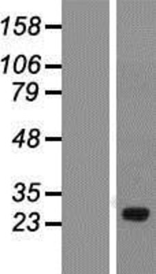 Western Blot: C1orf111 Overexpression Lysate (Adult Normal) [NBP2-04840] Left-Empty vector transfected control cell lysate (HEK293 cell lysate); Right -Over-expression Lysate for C1orf111.