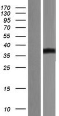 Western Blot: CD276 Overexpression Lysate (Adult Normal) [NBP2-06214] Left-Empty vector transfected control cell lysate (HEK293 cell lysate); Right -Over-expression Lysate for CD276.
