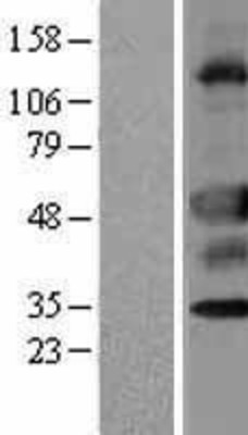 Western Blot: UNC5CL Overexpression Lysate (Adult Normal) [NBP2-05117] Left-Empty vector transfected control cell lysate (HEK293 cell lysate); Right -Over-expression Lysate for UNC5CL.