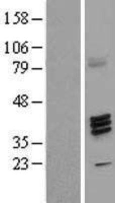 Western Blot: FUT7 Overexpression Lysate (Adult Normal) [NBL1-10867] Left-Empty vector transfected control cell lysate (HEK293 cell lysate); Right -Over-expression Lysate for FUT7.