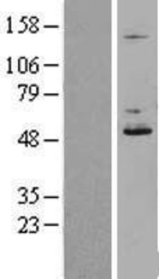 Western Blot: DDOST Overexpression Lysate (Adult Normal) [NBL1-09776] Left-Empty vector transfected control cell lysate (HEK293 cell lysate); Right -Over-expression Lysate for DDOST.