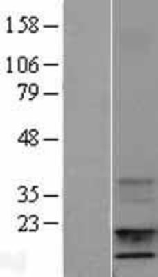 Western Blot: IGF1 Overexpression Lysate (Adult Normal) [NBL1-11866] Left-Empty vector transfected control cell lysate (HEK293 cell lysate); Right -Over-expression Lysate for IGF1.