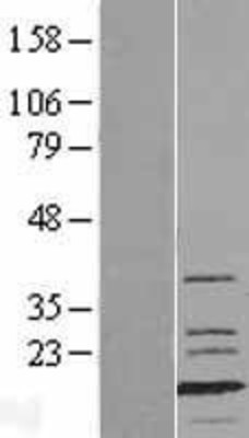 Western Blot: Fast skeletal myosin light chain 1 Overexpression Lysate (Adult Normal) [NBL1-13423] Left-Empty vector transfected control cell lysate (HEK293 cell lysate); Right -Over-expression Lysate for Fast skeletal myosin light chain 1.